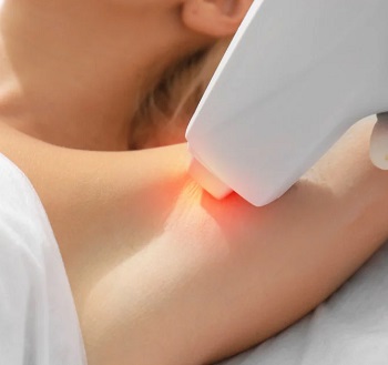 Depilação à Laser - Axilas